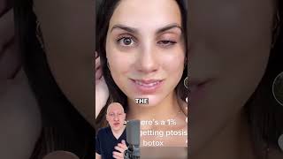 RARE Ptosis From Botox  Doctor Reacts [upl. by Ennayram989]