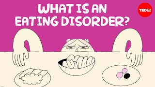 Why are eating disorders so hard to treat  Anees Bahji [upl. by Akcirre557]