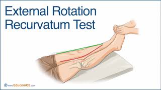 External Rotation Recurvatum Test [upl. by Shargel]