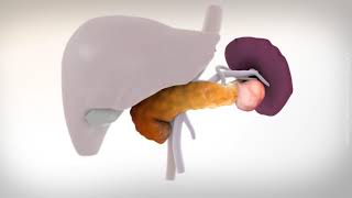 Laparoscopic distal pancreatectomy [upl. by Tonry534]