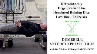 Retrolisthesis Degenerative Disc Disease Herniated Disc ExercisesAnterior Pelvic Tilt wDumbbell [upl. by Lytle]