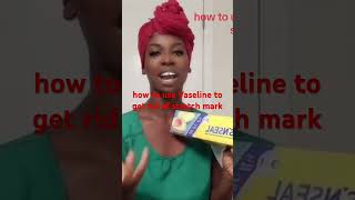 How to use Vaseline to get rid of stretch mark skincare stretchmark stretchmarksremoval [upl. by Ahsiener]