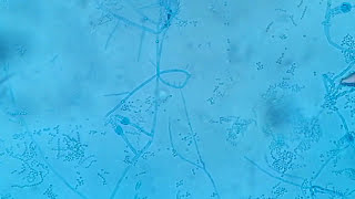 Penicillium growth and its structures under the microscope [upl. by Miles]