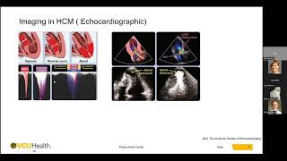 Imaging in Hypertrophic Cardiomyopathy  Mohammed Makkiya MD [upl. by Nilpik]