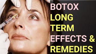 Botox LongTerm Effects amp Remedies 💉🕰️🌿 [upl. by Saunderson626]