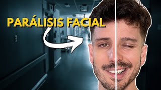 Qué Hacer si Tienes PARÁLISIS FACIAL  Tratamiento y Consejos [upl. by Yrreb]