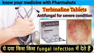 Terbinaforce tablets  Terbinafine tablets ip 250 mg  terbinafine tablets ip 250 mg uses in hindi [upl. by Nuawd11]