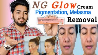 NG Glow Cream Review  NG Glow Cream For Melasma and Pigmentation [upl. by Dianne454]