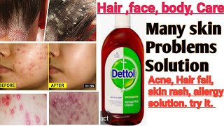 How to use Dettol skin hair body care  Right [upl. by Seravaj]