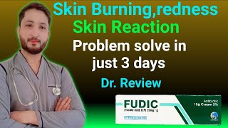 How to use fudic cream  skin burningrednessskin reaction problem solved  fudic cream Dr review [upl. by Horlacher321]