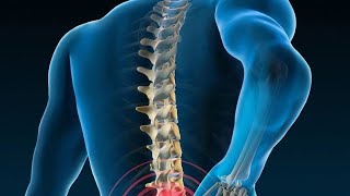 MRCP PACES Long Clinical Consultation Ankylosing Spondylitis New Format [upl. by Vicki]