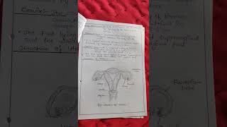 CASE STUDY ON PLACENTA PREVIA BSc Nursing Fourth year [upl. by Nathalie]