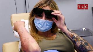 A Patient’s Final Hope in Dr Lee’s Hands  Dr Pimple Popper TLC [upl. by Tra]