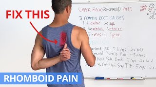 How to Fix Upper Back  Rhomboid Pain for GOOD 4 Effective Exercises [upl. by Weingartner841]