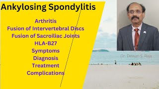 Ankylosing Spondylitis [upl. by Kleeman]