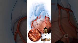 Amlodipine Tablet  Uses of Amlodipine Tablet [upl. by Ellainad]