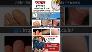 drakguptamrjफंगल इन्फेक्शन से ना हो परेशान homoeopathy homoeopathicmedicine shorts ytshorts [upl. by Anayaran326]