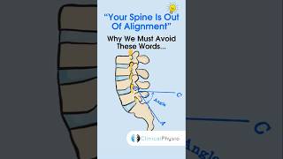 Spinal Alignment physicaltherapy physiotheraphy spinealignment [upl. by Byers]