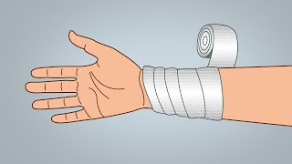 Bandaging Technique  Reverse Spiral [upl. by Noevad999]