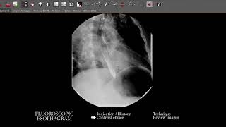 FL Esophagram  Search Pattern [upl. by Milks]