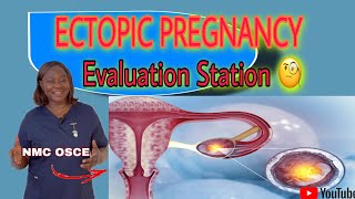 NMC OSCE  Evaluation Station Ectopic Pregnancy nmc osce pregnancy [upl. by Tedric]