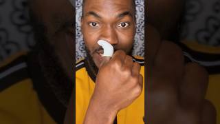 Nose Sebaceous Filaments  2 best ways to treat and prevent Blackheads [upl. by Bronson312]