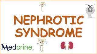 NEPHROTIC SYNDROME causespathophysiologydiagnosisfeatures and treatment [upl. by Ahsercul260]