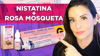 Resultado de 1 Mês Usando NistatinaÓleo de Rosa Mosqueta Pra Clarear Melasma e Manchas da Pele Acne [upl. by Ytsihc]