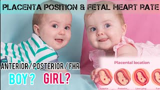 PLACENTA POSITION AND FHR VS BABY GENDER anterior placenta posteriorplacenta boybaby girlbaby [upl. by Acirrehs]