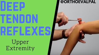 Deep Tendon Reflexes of the Upper Extremities [upl. by Port]