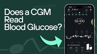 Does a CGM Read Glucose in My Blood and What is Interstitial Fluid [upl. by Honeyman]