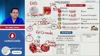 FIEBRE REUMATICA  RESUMEN  CARDIOLOGÍA [upl. by Aned]