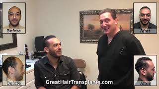 Affordable Hair Transplant amp Hair Restoration In Tampa Florida  Dr Brett Bolton [upl. by Mareld]