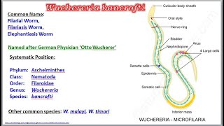 Wuchereria Filarial Worm [upl. by Ttezil151]