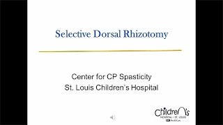 Selective Dorsal Rhizotomy SDR at St Louis Childrens Hospital [upl. by Eachern]