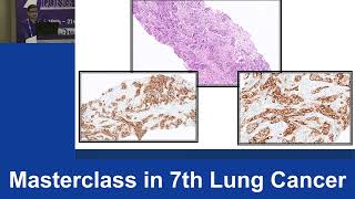 CRSF 7th Masterclass  Dr Rajiv Kumar Kaushal Interpreting PDL1 MSI amp TMB in NSCLC [upl. by Harman]