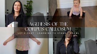 Agenesis of the Corpus Callosum  Let’s Chat  Learning to Stand  crawl [upl. by Dove]