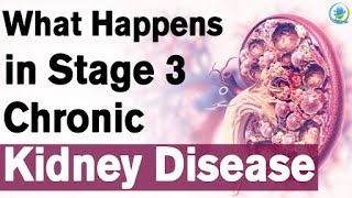 Stage 3 Chronic Kidney Disease Treatment  Kidney Treatment in Ayurveda [upl. by Lebama]