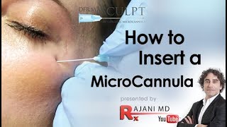 How to Insert the MicroCannulaDermal FillersDr Rajani [upl. by Riella263]