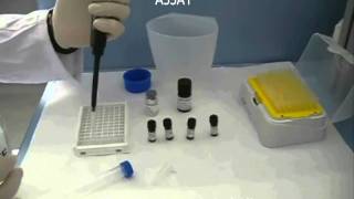 Phosphatase assay Microcystest [upl. by Aloibaf56]