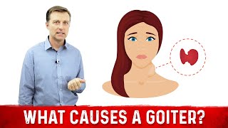 What Causes a Goiter Causes of Thyroid Enlargement – DrBerg [upl. by Trinetta209]