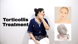 Torticollis Physiotherapy Exercises and Stretches  Torticollis Treatment in hindi [upl. by Nospmis381]