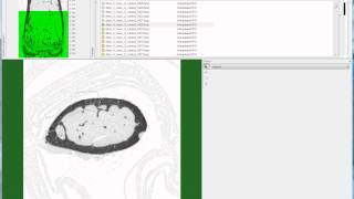 Bruker microCT tutorial Setting the cortical VOI for the mouse femur [upl. by Adnicaj]