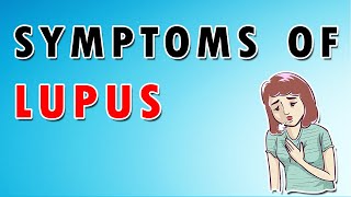 Lupus Signs and Symptoms  Joint Pain Rash and Fingers Ulcers [upl. by Ylloh]