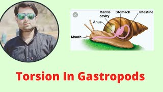 Torsion In Gastropods [upl. by Clava]