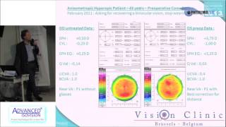 Dr Thierry VANDORSELAER  Les traitements Hypermétropiques donnent une bonne NV et DV [upl. by Huppert]
