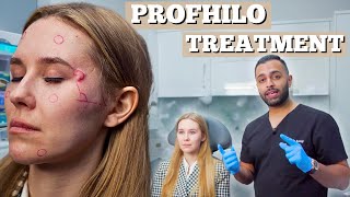 Profhilo Treatment  Dermal Filler For Fine Lines amp Wrinkles  Dr Somji amp Dr Solomon Demonstrate [upl. by Margery]