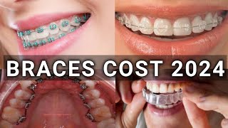 Braces Type amp Treatment Cost 2024  Metal vs Ceramic vs Lingual vs Invisalign Braces  Latest [upl. by Mroz113]