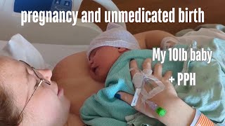 My Pregnancy and Unmedicated Birth of My 10lb Baby Boy  Induced amp No Epidural [upl. by Tien22]