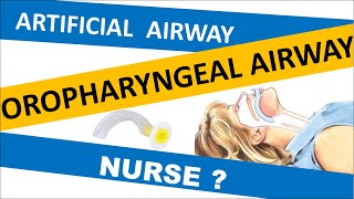 OROPHARYNGEAL AIRWAY INSERTION PROCEDURE  OPA  Artificial Airway  Oral Airway  Airway adjuncts [upl. by Sharia]